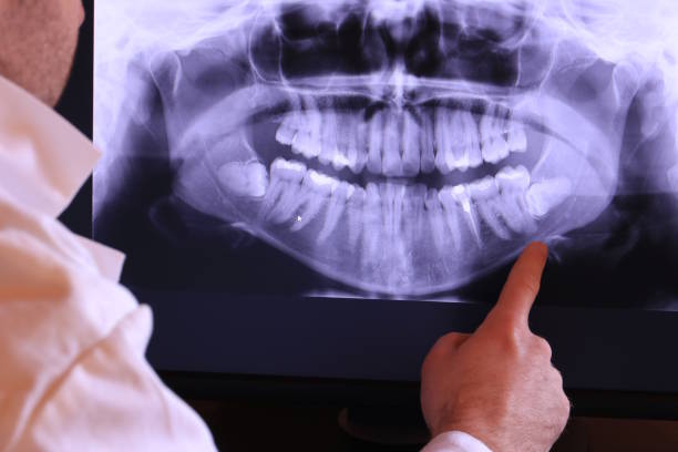 Best Emergency Treatment for Dental Infections or Abscesses in Colfax, WA