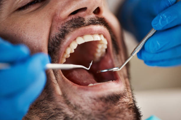 Best Emergency TMJ Treatment in Colfax, WA